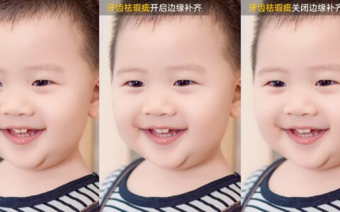像素蛋糕 Android版：牙齿美化